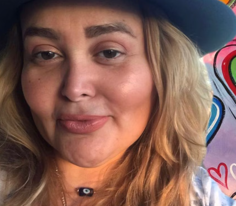 Sheyla Tadeo, la modelo que perdió 58 kilogramos, ahora ayuda a niños quemados donando piel.