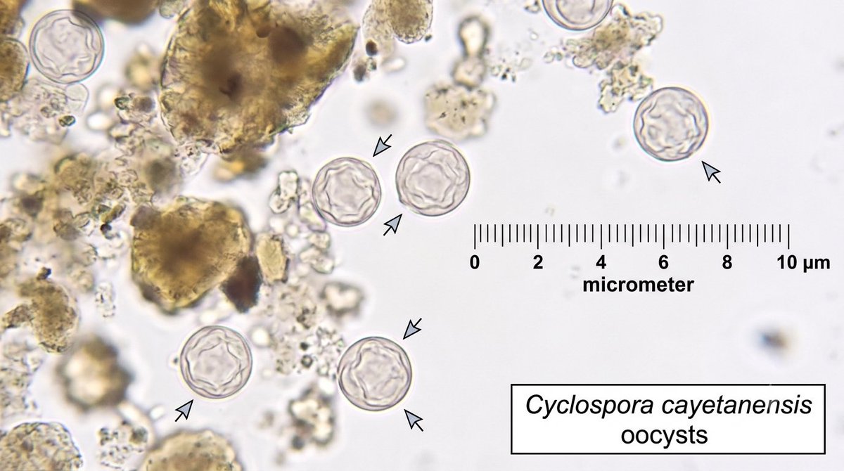 ¡Falsa alarma en México! Salud descarta brote masivo de Cyclospora tras alerta sanitaria en EE. UU.